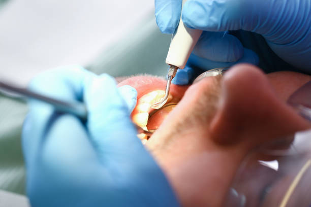 Best Pediatric Emergency Dentist in Advance, MO